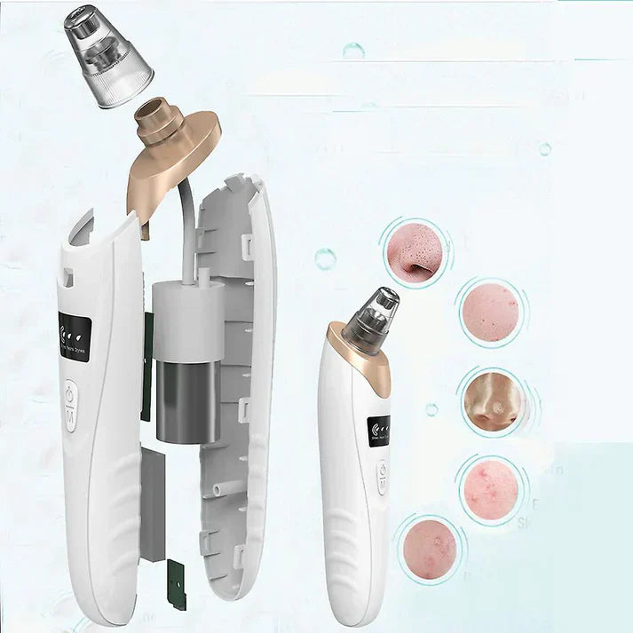 Electric Face Vacuum Blackhead Remover & Pore Cleaner | Deep Cleansing Tool for Nose and Face