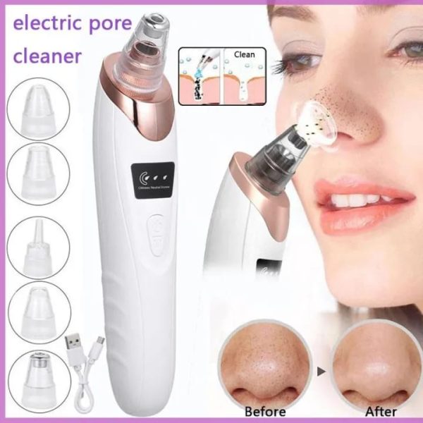 Electric Face Vacuum Blackhead Remover & Pore Cleaner | Deep Cleansing Tool for Nose and Face