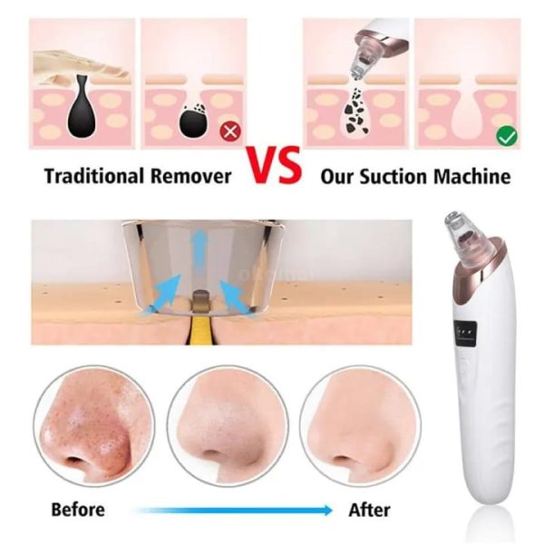 Electric Face Vacuum Blackhead Remover & Pore Cleaner | Deep Cleansing Tool for Nose and Face